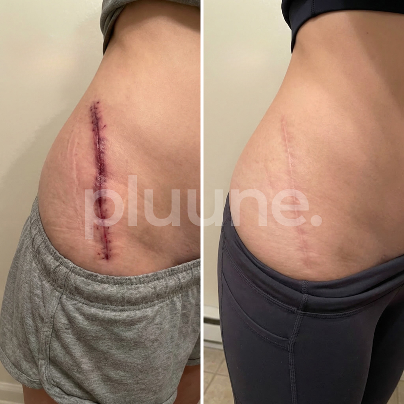 Nicole T, 38
