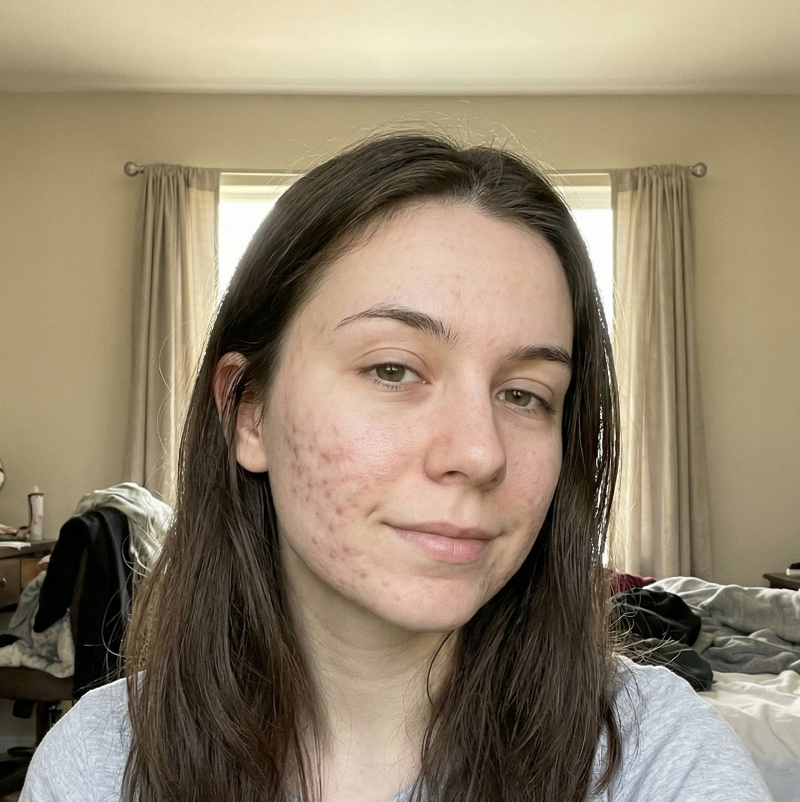 Teen, months in
