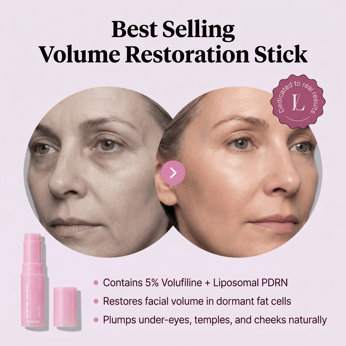 Before and after graphic: woman's face looking fuller under the eyes, headline "Best Selling Volume Restoration Stick"