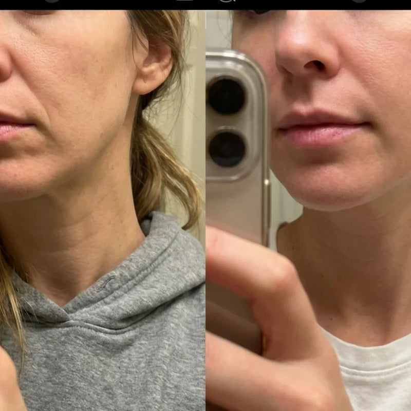 Rachel, 39