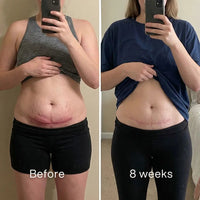 Before and after mirror selfies: pink c-section scar on the lower abdomen, lighter and flatter at 8 weeks