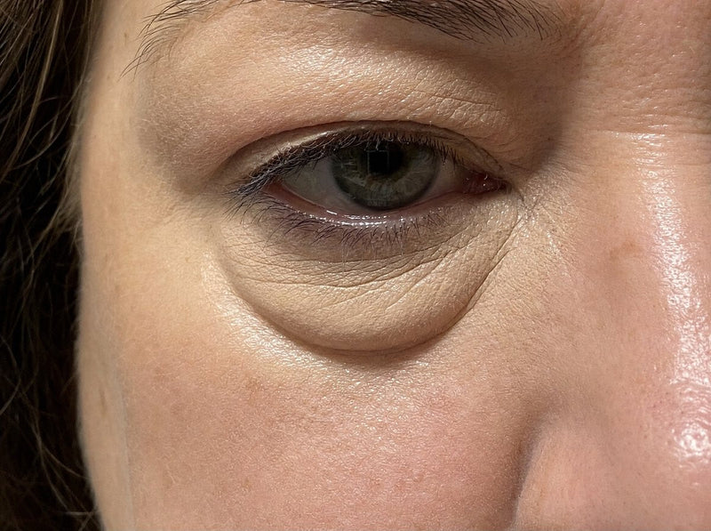 Concealer