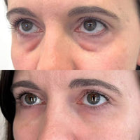 Instant Under-Eye Tightener™ - Pluune