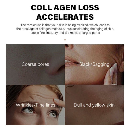 Skin concern graphic: "Collagen loss accelerates" with four photos of coarse pores, sagging, fine lines and dull skin