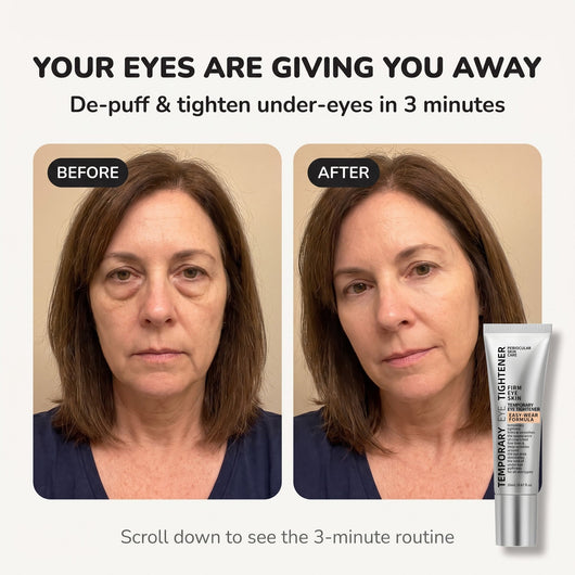 Reverse-Aging Temporary Eye Tightener: Younger Looking Eyes In 90 Seconds - Pluune